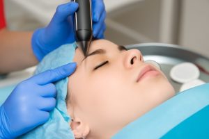 blocked tear duct surgery